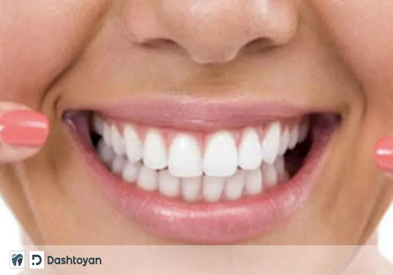 Dental orthopedic prosthetics
