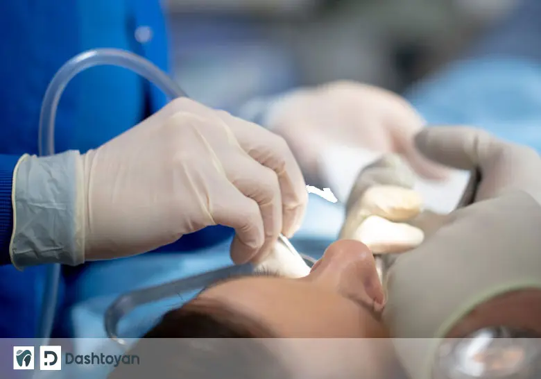 Oral surgery