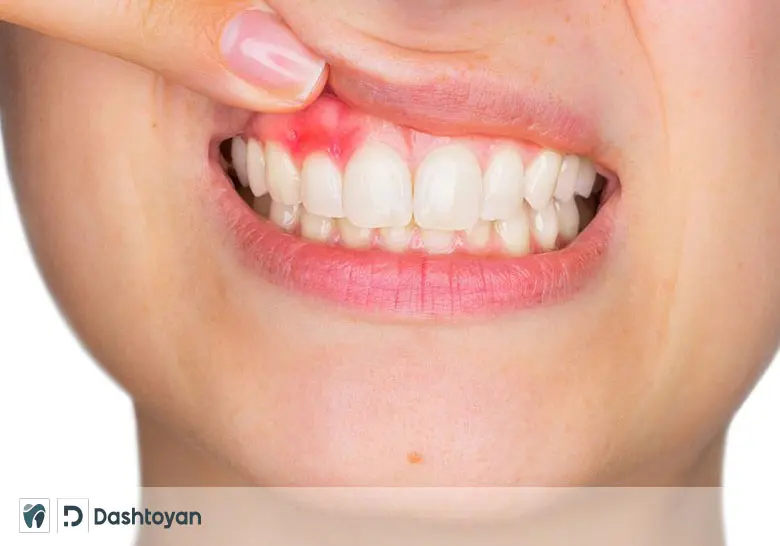 Periodontology